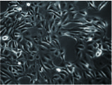 人類羊膜上皮幹細胞  Human Amniotic Epithelial (AE) Stem Cells